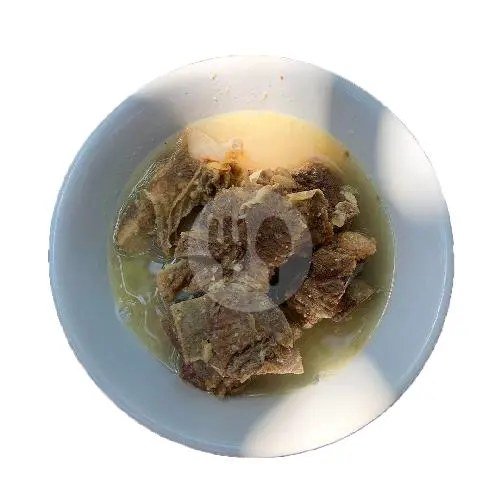 Tulang Rusuk atau Iga